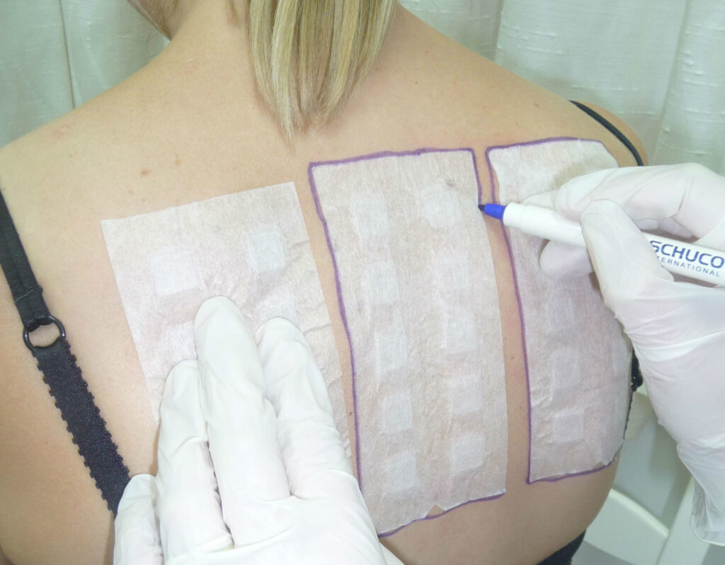 Allergy Testing for Children and Adults Royal Tunbridge Wells UK